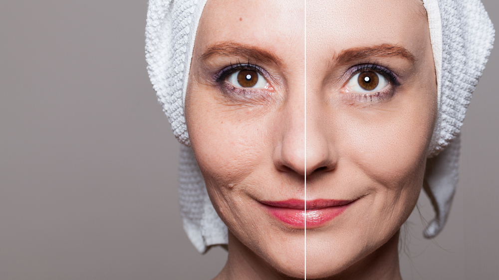 Skin Rejuvenation