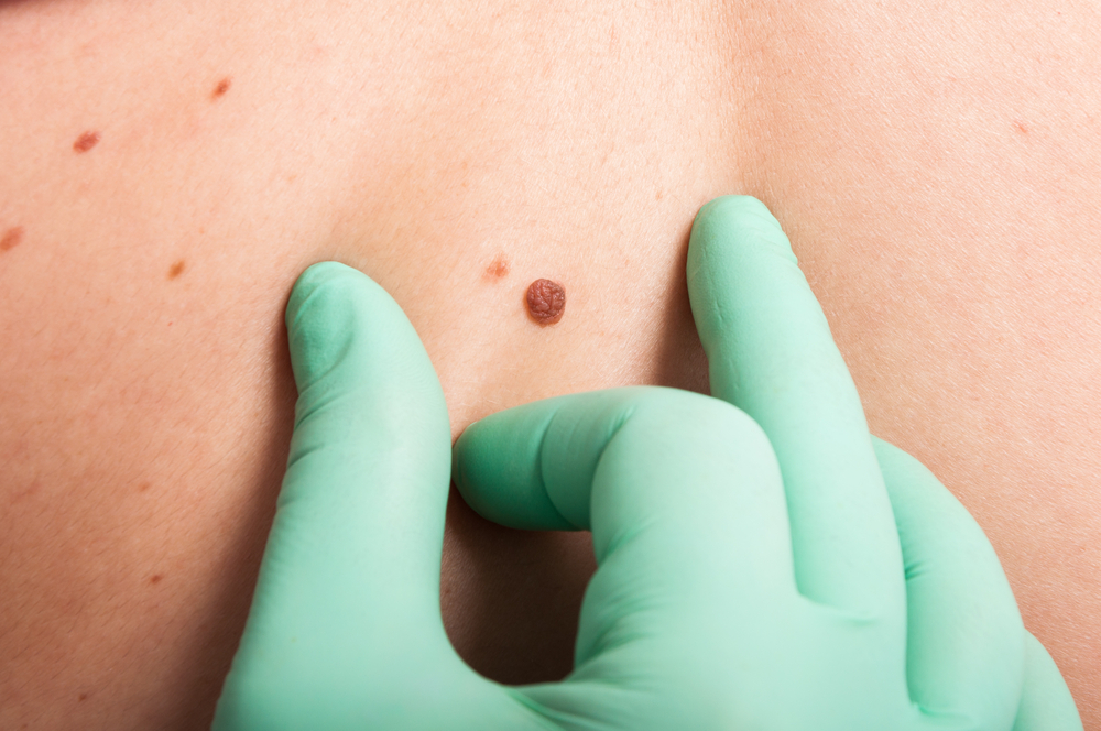 Skin Problem Solution