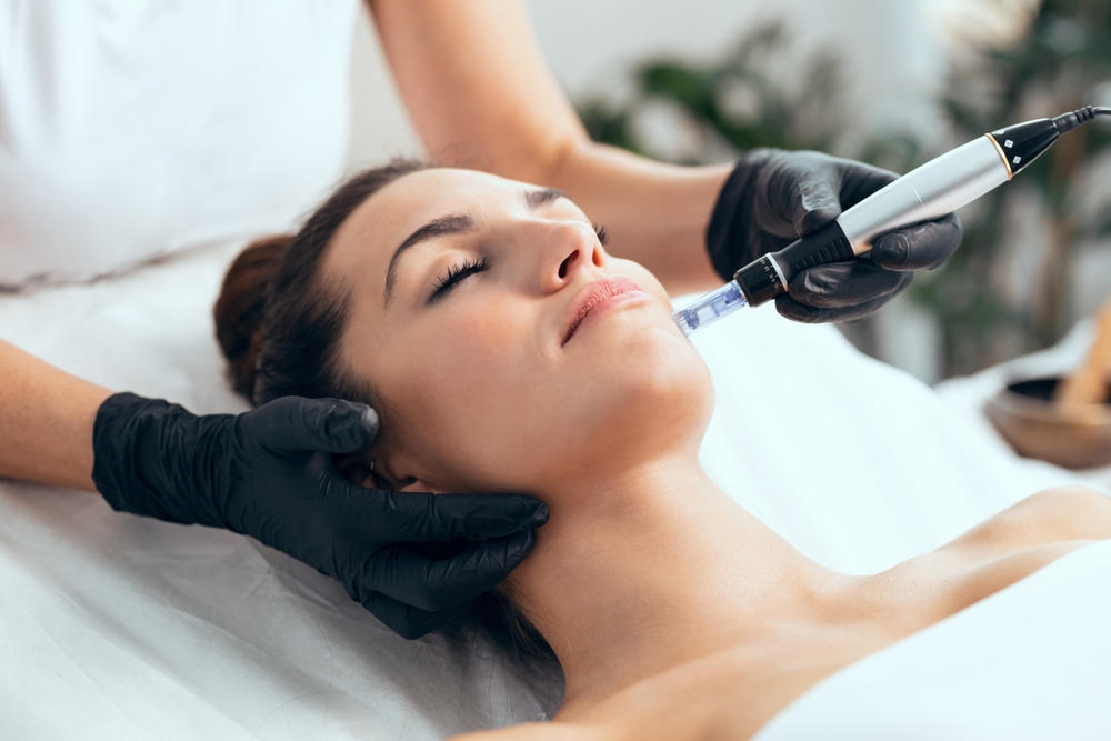 Microneedling Treatment