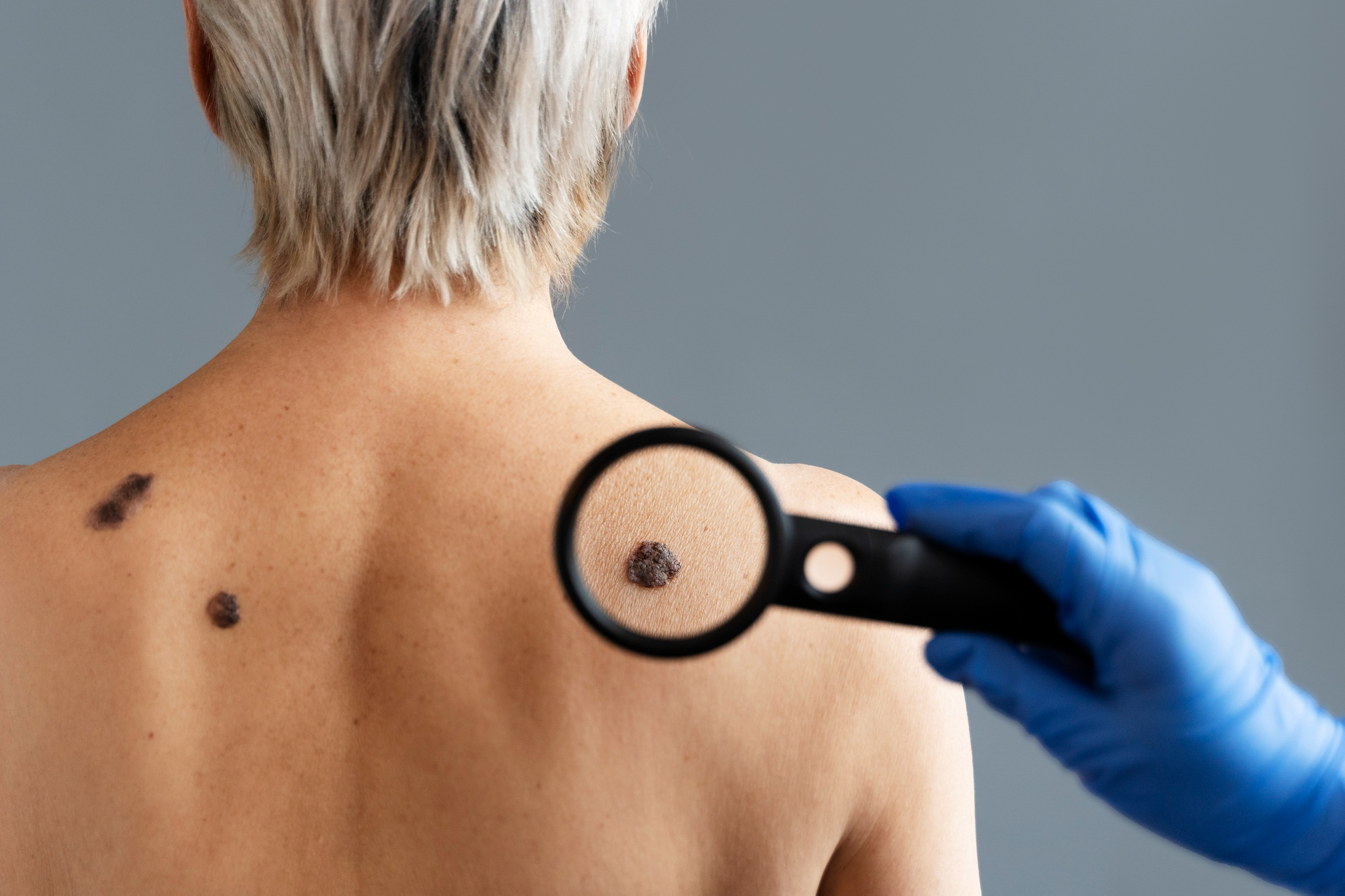 Dermatologis