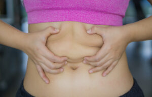 Tummy Tuck Surgery