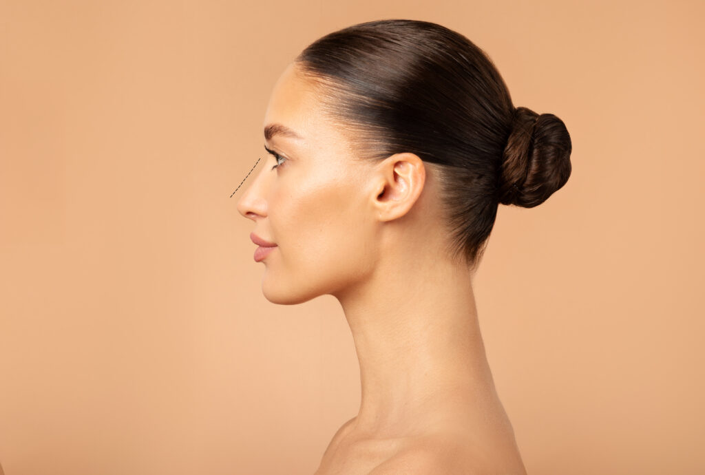 Reshape Your Confidence with Rhinoplasty