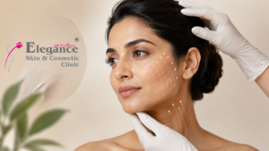 facelift surgery in ahmedabad