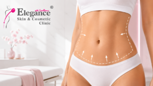 liposuction surgery in Ahmedabad