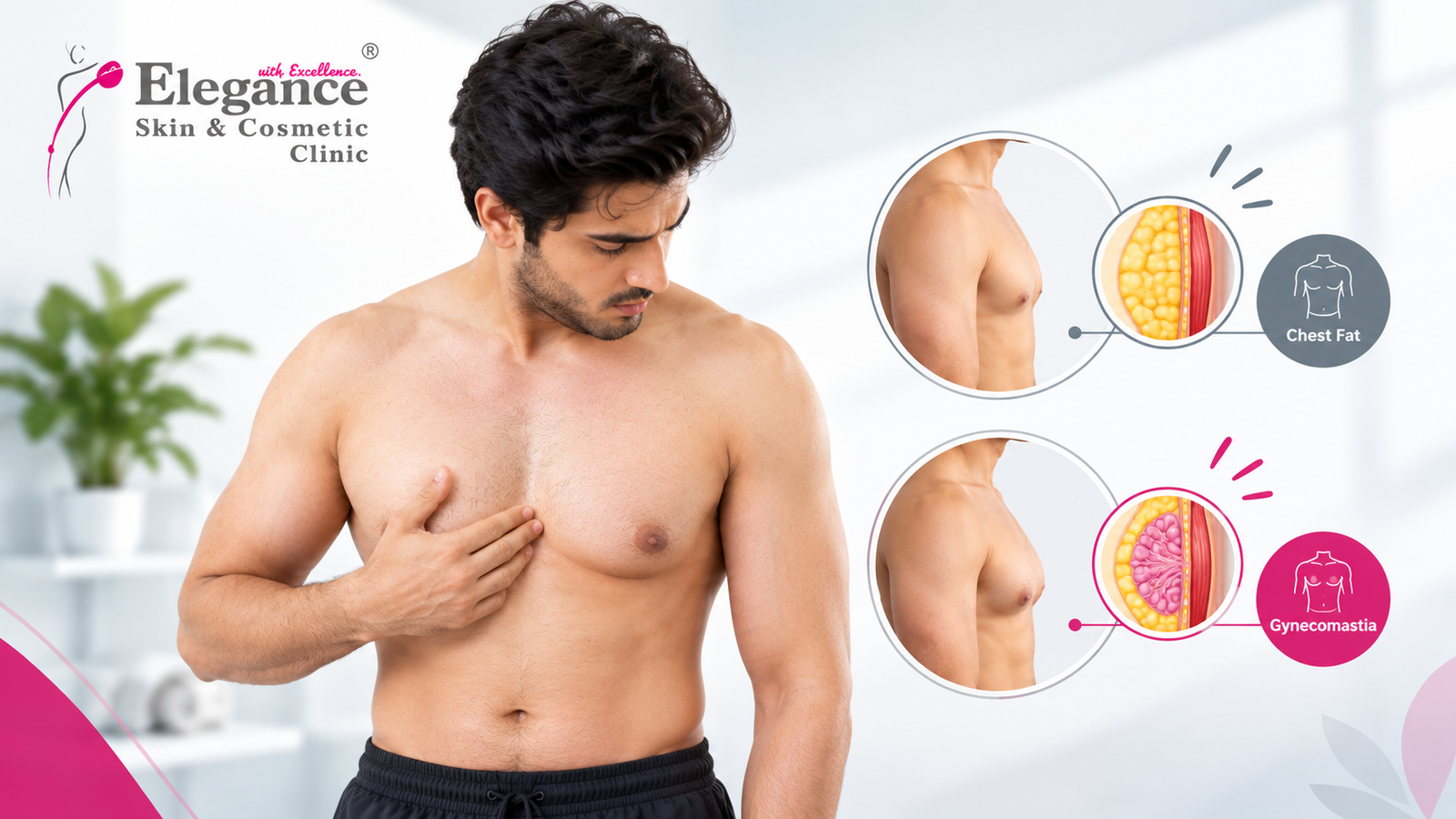 Best Gynecomastia surgery in ahmedabad